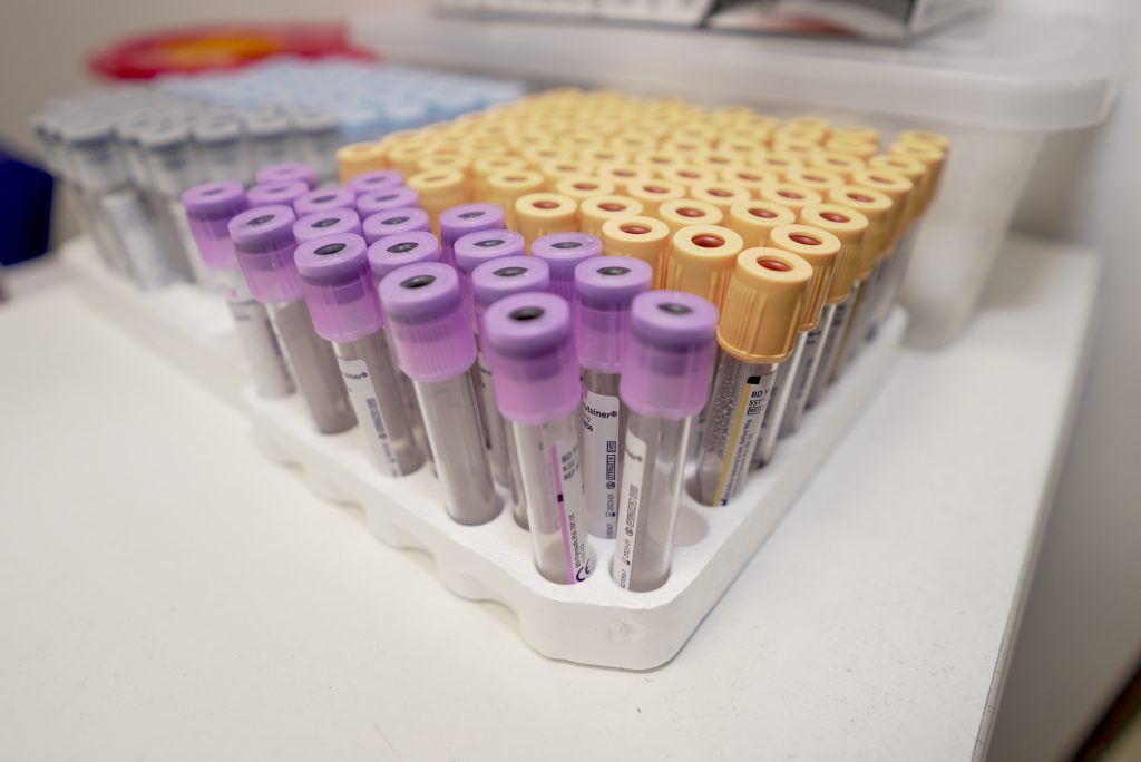 Zestaw probówek laboratoryjnych z różnymi kolorami korków, używanych do analizy próbek krwi.